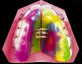 Imatge ortopèdia dentofacial