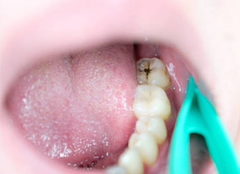 Imatge dent en ortodòncia
