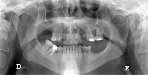 Radiografia digital panoràmica